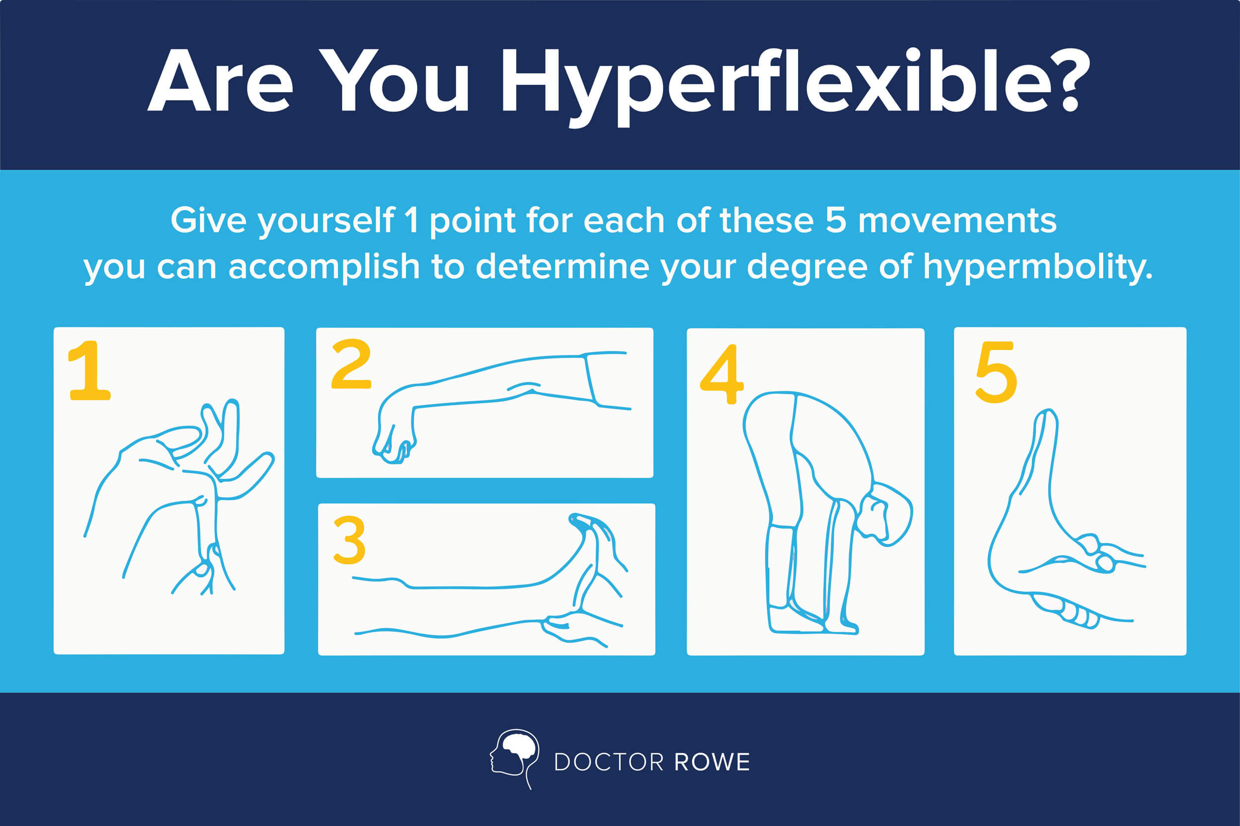 Hypermobility breighton score Justliveblog nl